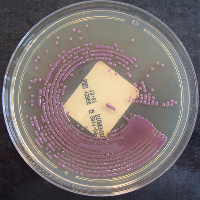 e.coli生长